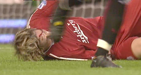 torres-injury.jpg